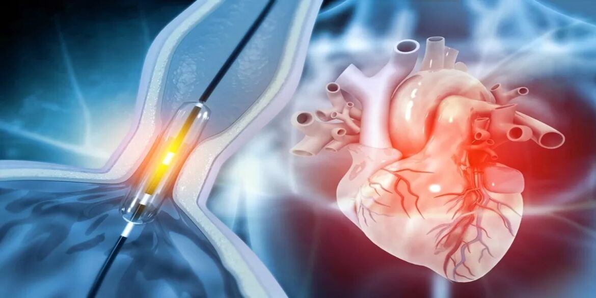 coeur " عمليات قسطرة الشرايين في تونس في تزايد مستمر"