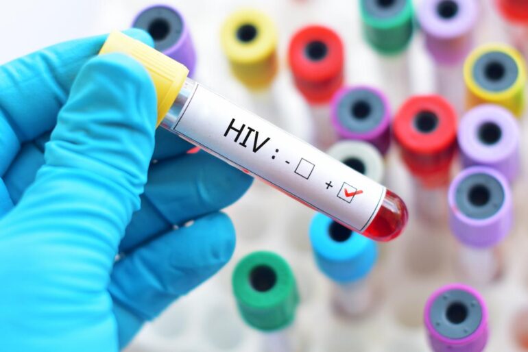 sida الإدارة الجهوية للصحة بقفصة تنفي اكتشاف حالات إصابة بالسيدا بالمتلوي