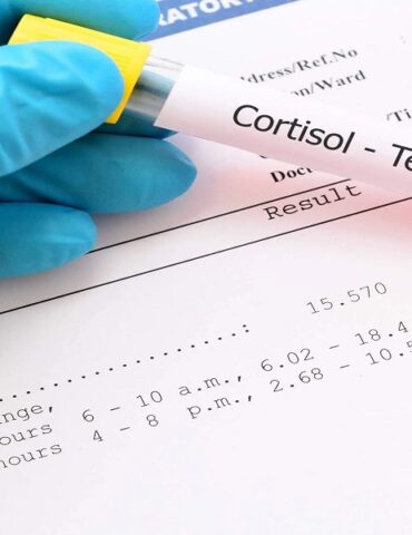 cortisol تحذير من تداعيات ارتفاع هرمون "الكورتيزول" في الجسم