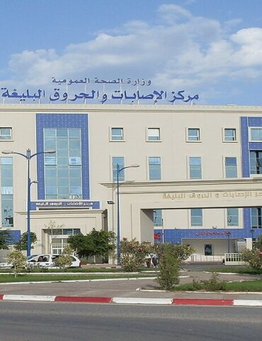 7ourou9 بن عروس: تعزيز الخدمات الصحية بمركز الحروق والإصابات البليغة