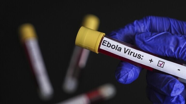 ايبولا إسرائيل تعلن تسجيل أول حالة اشتباه بالإصابة بفيروس إيبولا