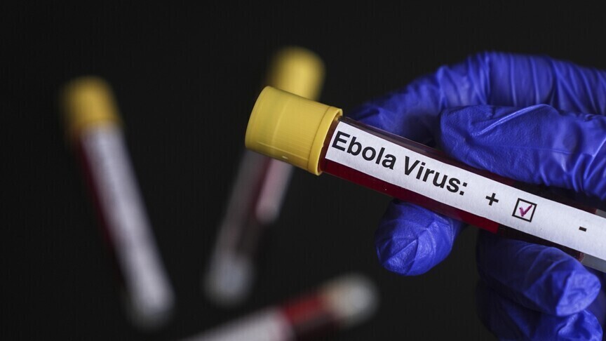 ايبولا إسرائيل تعلن تسجيل أول حالة اشتباه بالإصابة بفيروس إيبولا